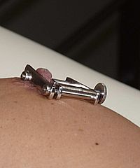 Amateur Needle Pain